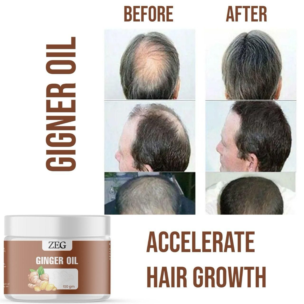 ZEG 100% Natural GINGER OIL 100GM (Pack of 2) | Body, Skin Massage & Hair Nourishment