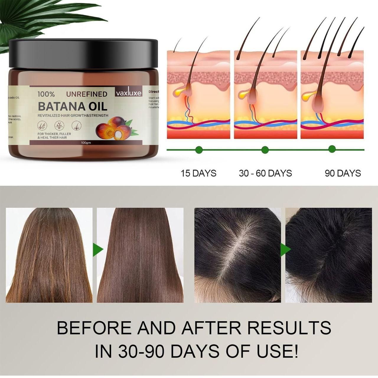 Vaxluxe Batana Oil 100g – Hair Growth & Strengthening (Pack of 1)